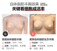 昭通做自體脂肪豐胸，怎么提高脂肪存活率