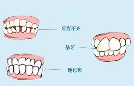 牙齒矯正