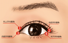 廈門開眼角術后完全恢復需多久