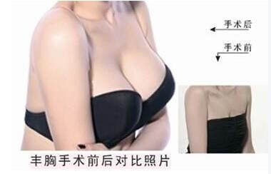 有什么辦法讓乳房變美呢？