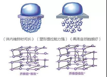 玻尿酸為什么維持時間短？