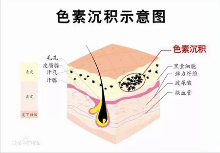 盤點四種需要來一針的膚質