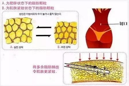 四月不吸脂，五、六、七月徒傷悲......