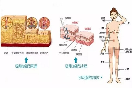 四月不吸脂，五、六、七月徒傷悲......