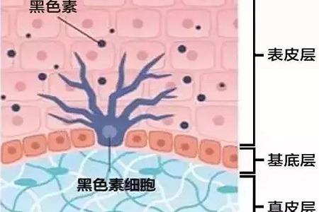 祛斑偏方“害死人”，小仙女們可長點心吧！