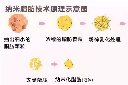 拿什么拯救你，我的黑眼圈？