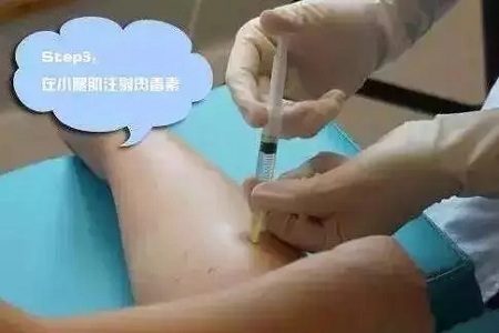 這有一個快速又持久瘦小腿的方法！請注意查收！