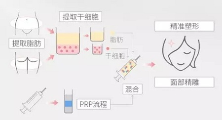 美萊實驗室：瘦臉、ReFa都解決不了你的臉大問題交給我就對了