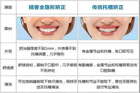 這種牙齒矯正方式，96%的人都會選擇！