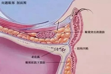 顯老淚溝，你還要任其放肆嗎？