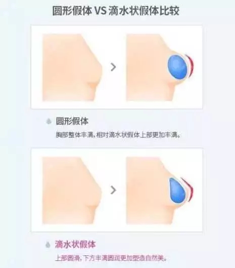 [我問大醫師]隆乳手術問題，你想要的答案，這里都有