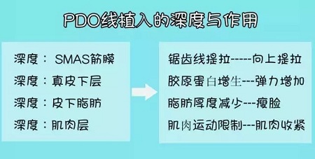 關于*雕，你想了解的都在這里！