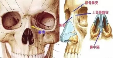 側面看鼻梁不矮,正面看鼻子卻很塌是什么原因？