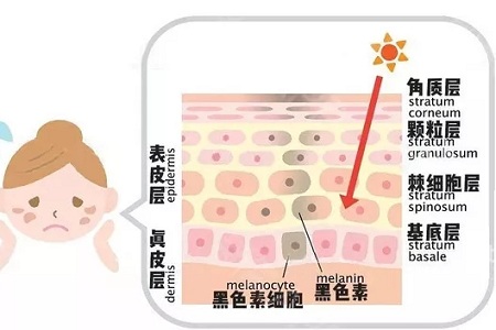 祛斑的這些坑你了解了嗎