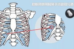 深圳隆鼻醫院做軟骨隆鼻多少錢，術后安全嗎